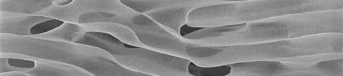 Eine vergrössere Ansicht des neuen Nanoschwamm-Materials.