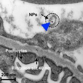 Transmissionselektronenmikroskopische Detailaufnahme eines Nierenschnitts, der blaue Pfeil kennzeichnet mehrere Gold-Nanopartikel in einem umhüllenden «süssen» Polymer-Nanopartikel